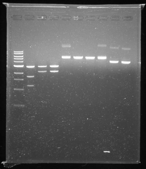 interpretation of dna gel electrophoresis results|3.1: Gel Electrophoresis .
